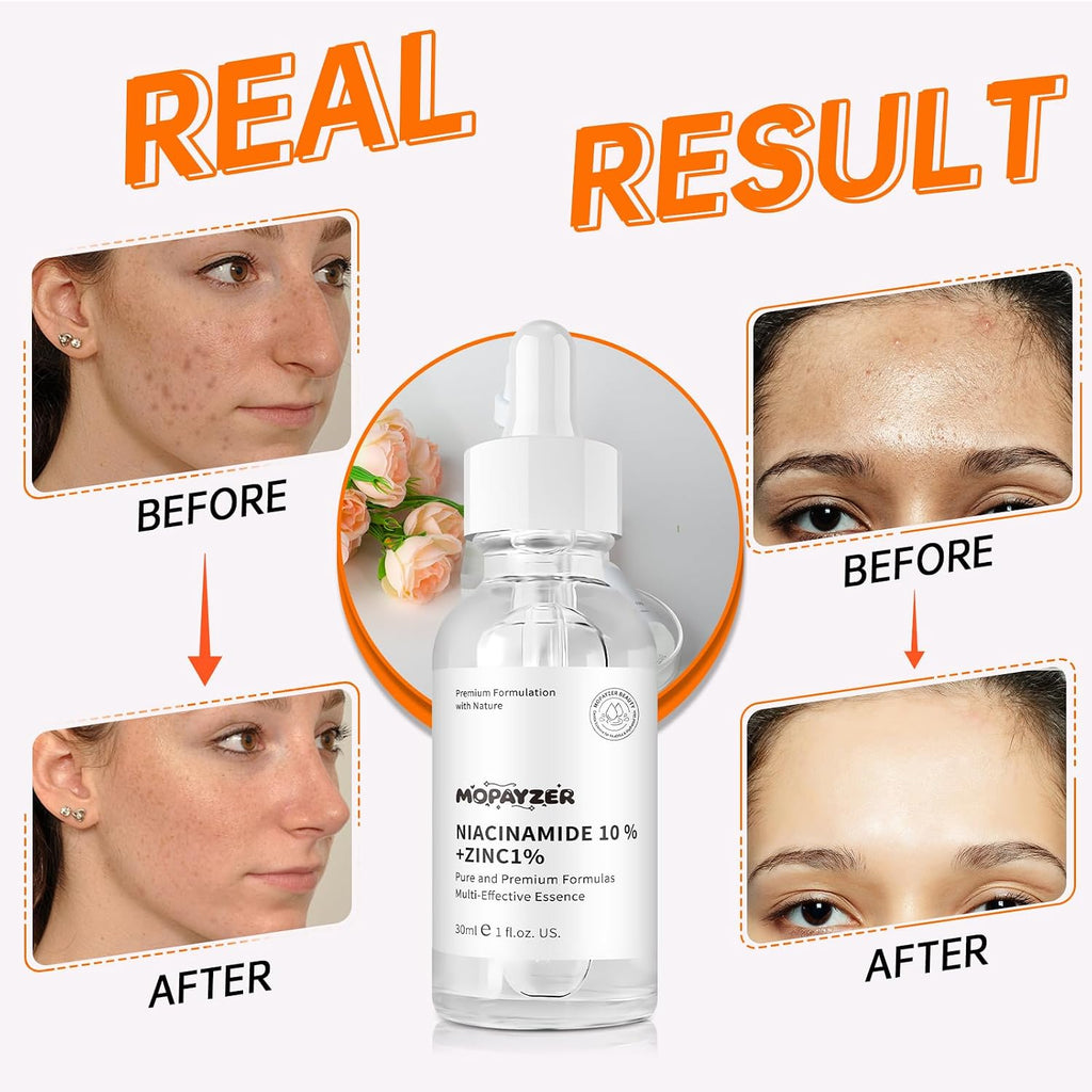 Niacinamide 10% + Zinc 1% Serum, Anti-Aging Niacinamide Serum for Face, 1PCS Moisturizing Facial Serum for All Skin Type, Women Face Skin Care.